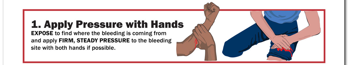 1. Apply Pressure with Hands. EXPOSE to find where the bleeding is coming from and apply FIRM, STEADY PRESSURE to the bleeding site with both hands if possible.